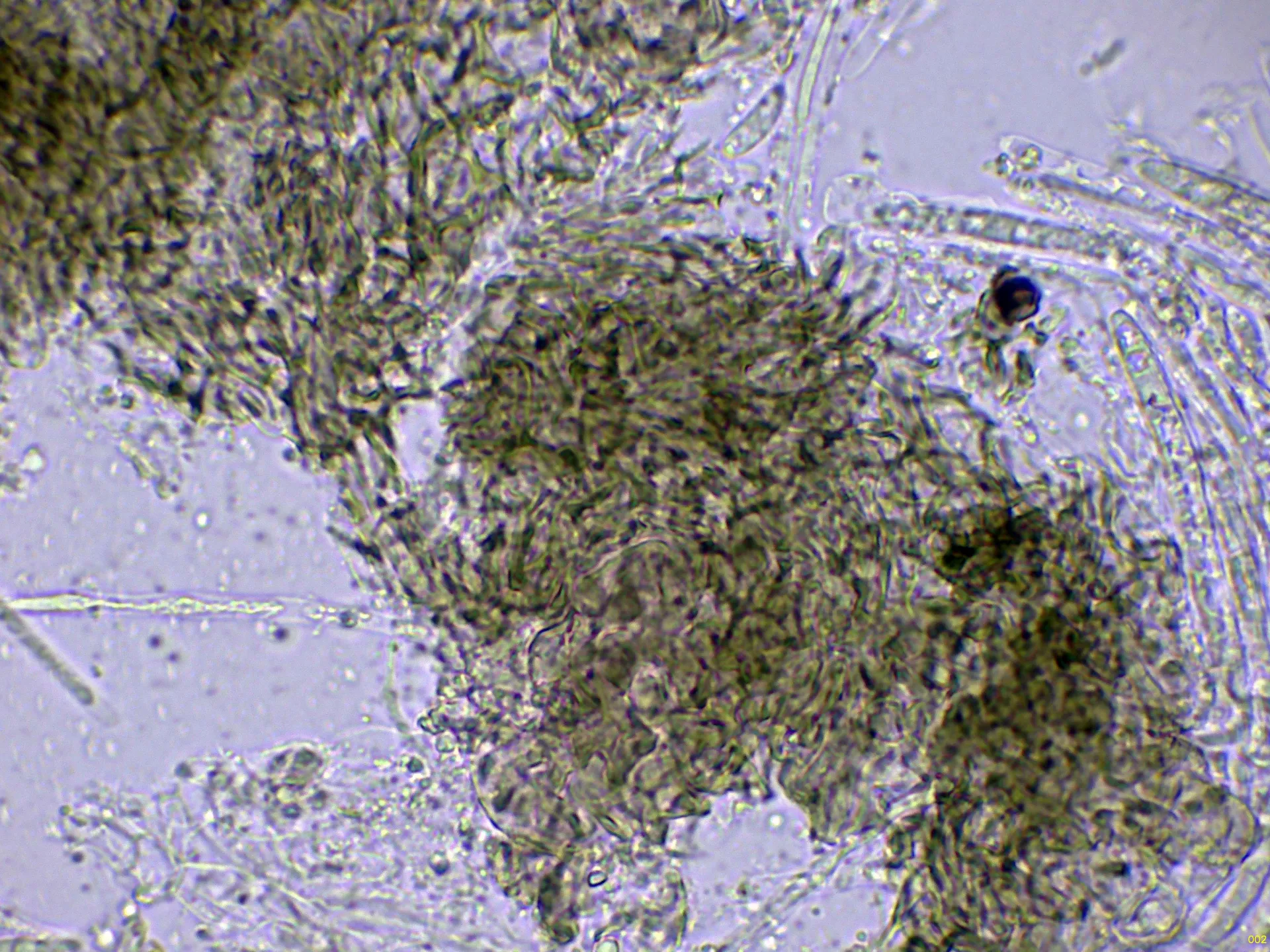 Microscopía de Mollisia oblonga - 12 - Excípulo agua-002